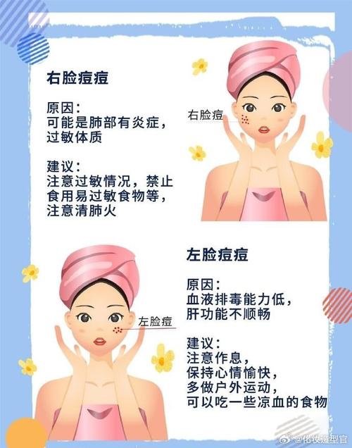 脸上长痘痘怎么调理 脸上长痘痘调理方法