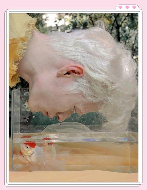 白化病会遗传吗 白化病会遗传给孩子吗